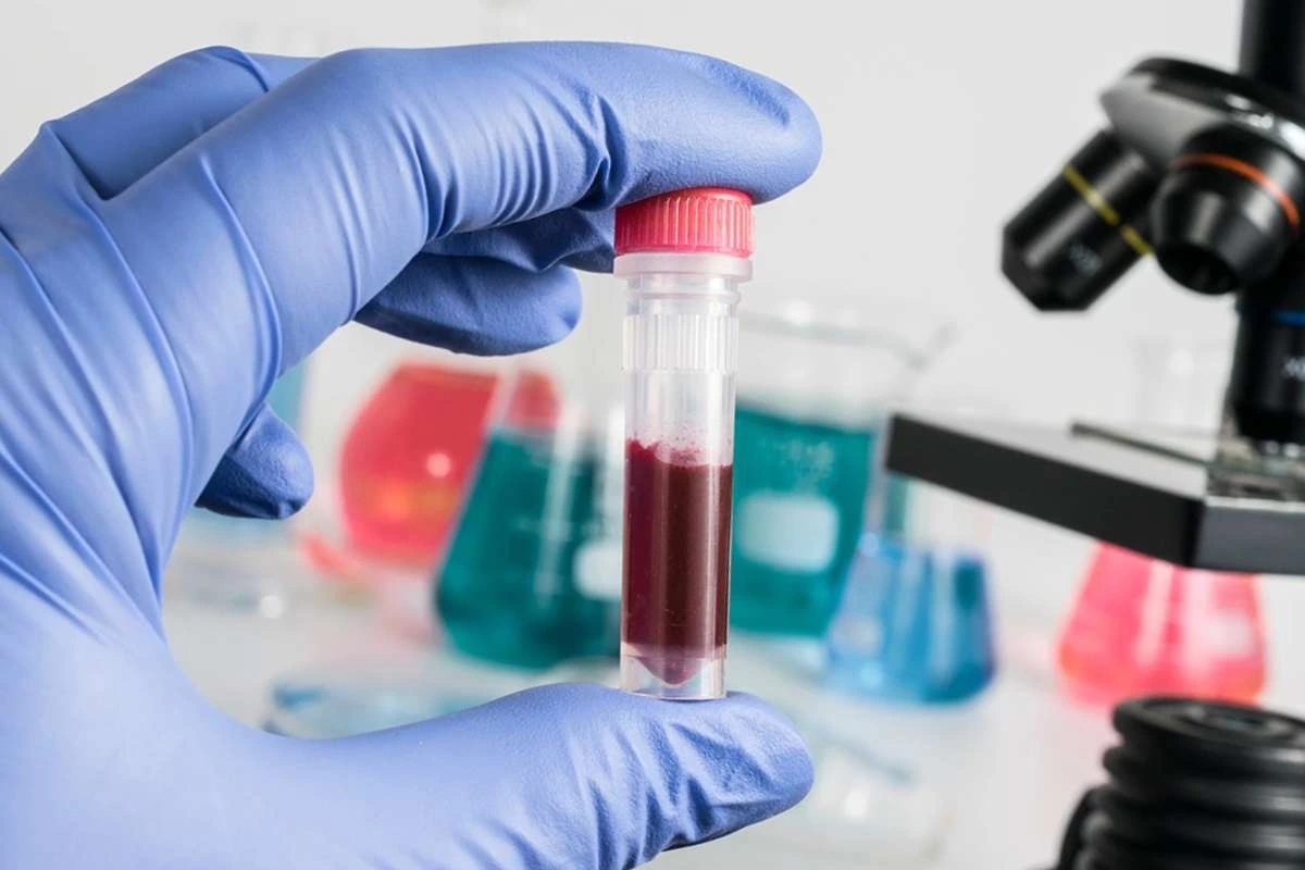 Иммунология рядом: как разобраться в иммунологических исследованиях в Москве