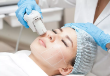 SMAS лифтинг: преимущества